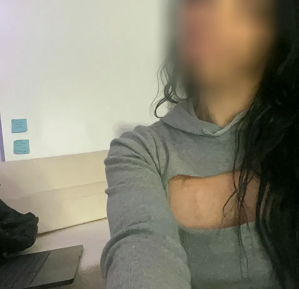 Lily, 20